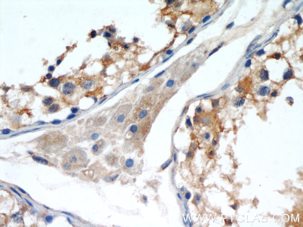 Immunohistochemistry (IHC) staining of human testis tissue using Septin 9 Polyclonal antibody (10769-1-AP)