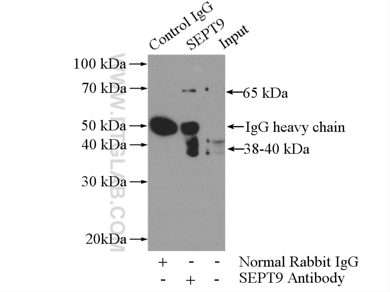 Immunoprecipitation (IP) experiment of mouse brain tissue using Septin 9 Polyclonal antibody (10769-1-AP)