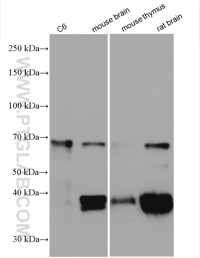 Western Blot (WB) analysis of various lysates using Septin 9 Polyclonal antibody (10769-1-AP)
