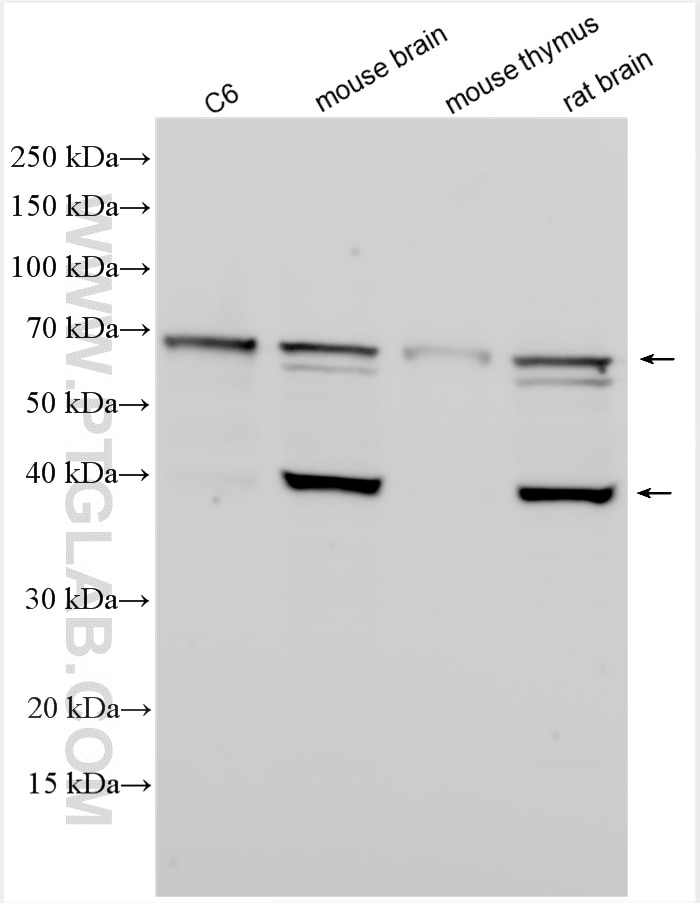 Western Blot (WB) analysis of various lysates using Septin 9 Polyclonal antibody (10769-1-AP)