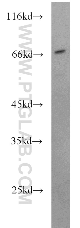 Western Blot (WB) analysis of HeLa cells using Septin 9 Polyclonal antibody (10769-1-AP)