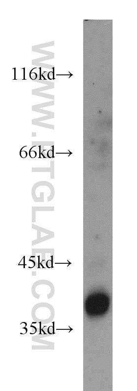 WB analysis of mouse spleen using 10769-1-AP