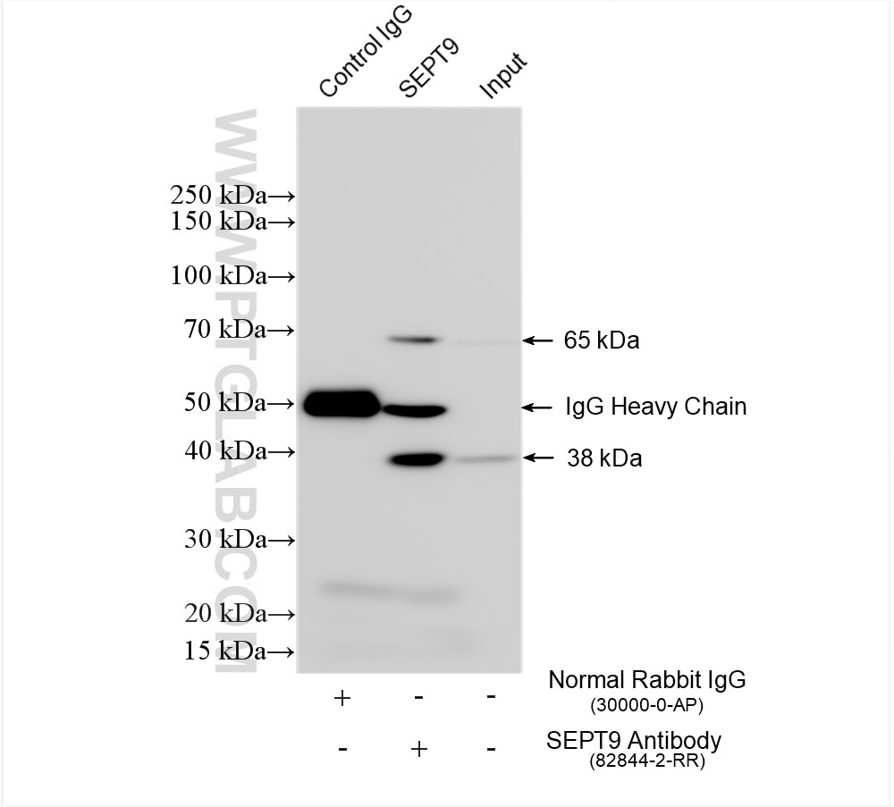 Immunoprecipitation (IP) experiment of mouse brain tissue using SEPT9 Recombinant antibody (82844-2-RR)