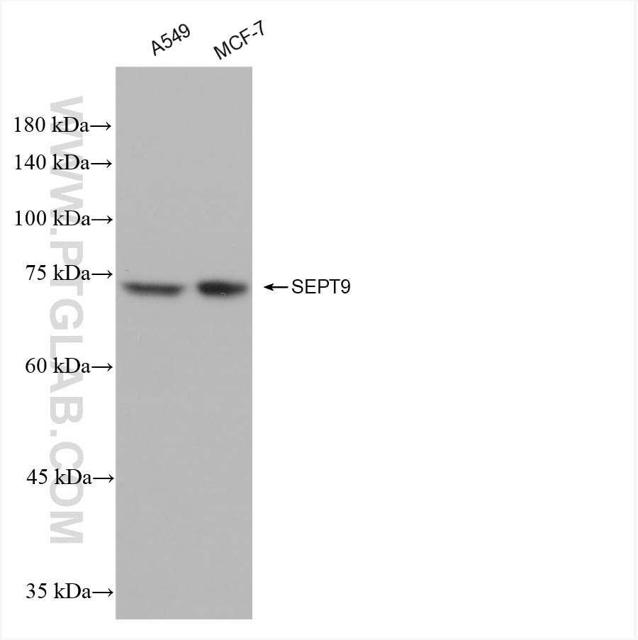 Western Blot (WB) analysis of various lysates using SEPT9 Recombinant antibody (82844-2-RR)