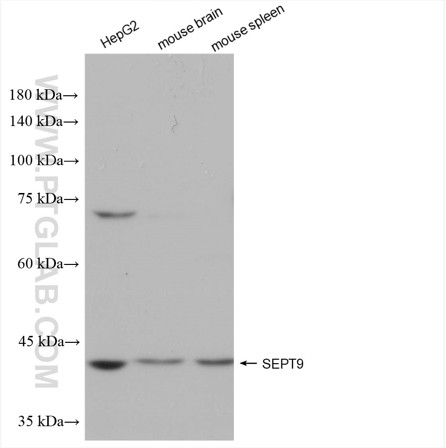 Western Blot (WB) analysis of various lysates using SEPT9 Recombinant antibody (82844-2-RR)
