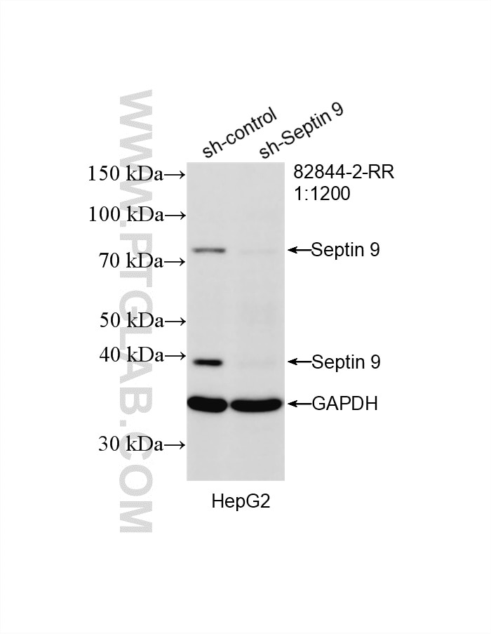 Western Blot (WB) analysis of HepG2 cells using Septin 9 Recombinant monoclonal antibody (82844-2-RR)