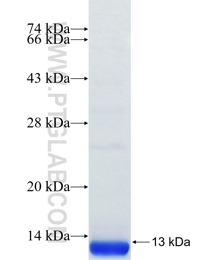 SEPW1 fusion protein Ag38385 SDS-PAGE SEPW1 fusion protein Ag38385 SDS-PAGE