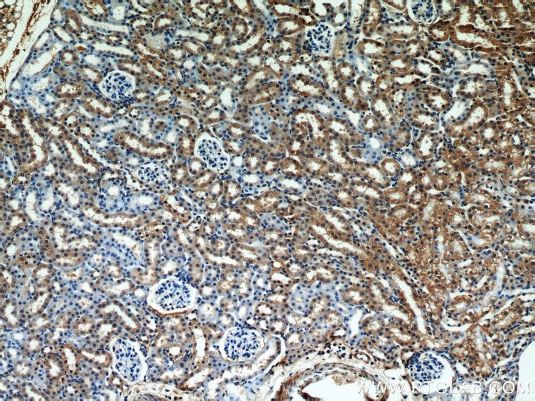 IHC staining of mouse kidney using 15333-1-AP