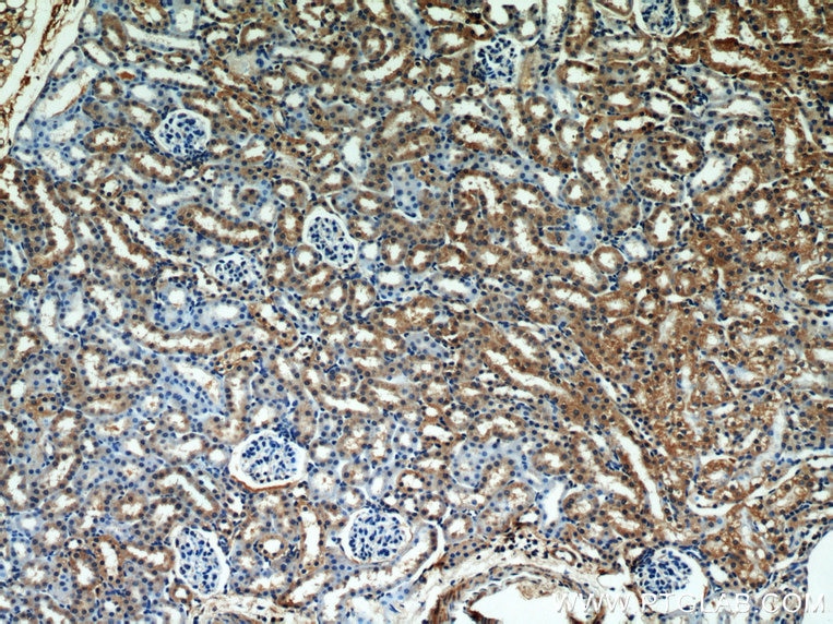 Immunohistochemistry (IHC) staining of mouse kidney tissue using SEPX1 Polyclonal antibody (15333-1-AP)