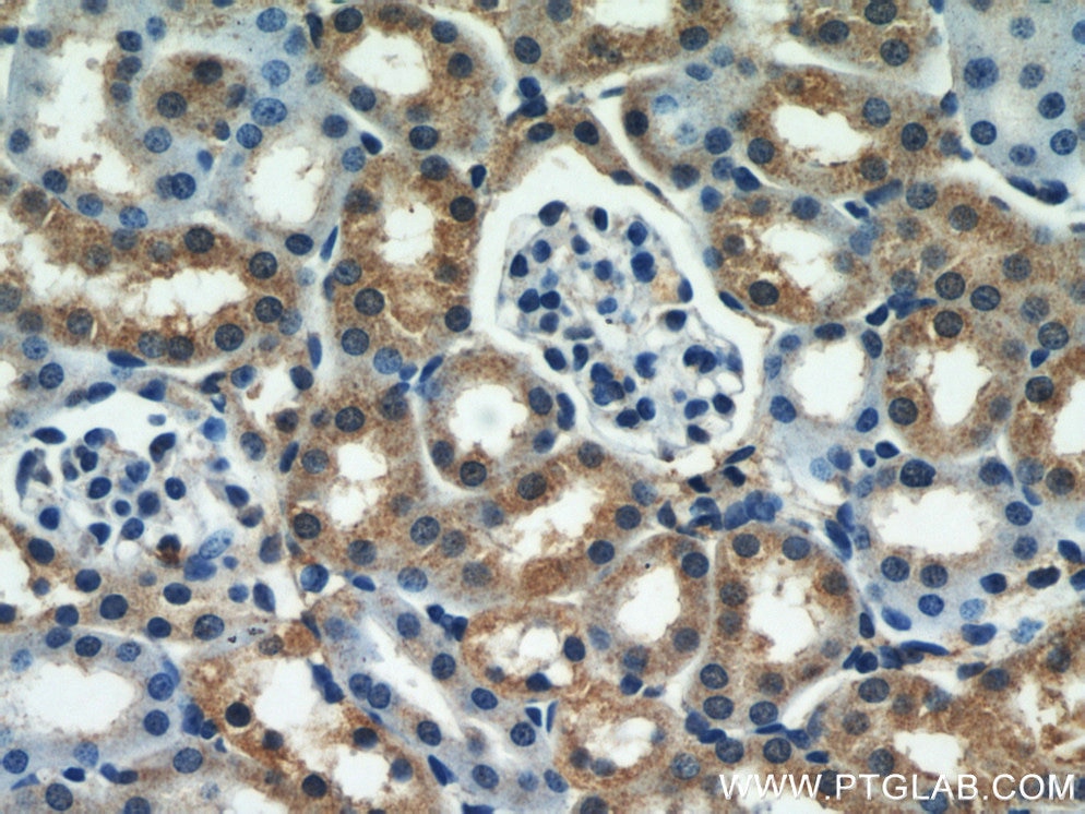 Immunohistochemistry (IHC) staining of mouse kidney tissue using SEPX1 Polyclonal antibody (15333-1-AP)