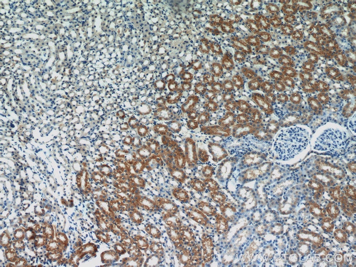 IHC staining of mouse kidney using 15333-1-AP