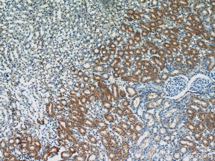 Immunohistochemistry (IHC) staining of mouse kidney tissue using SEPX1 Polyclonal antibody (15333-1-AP)