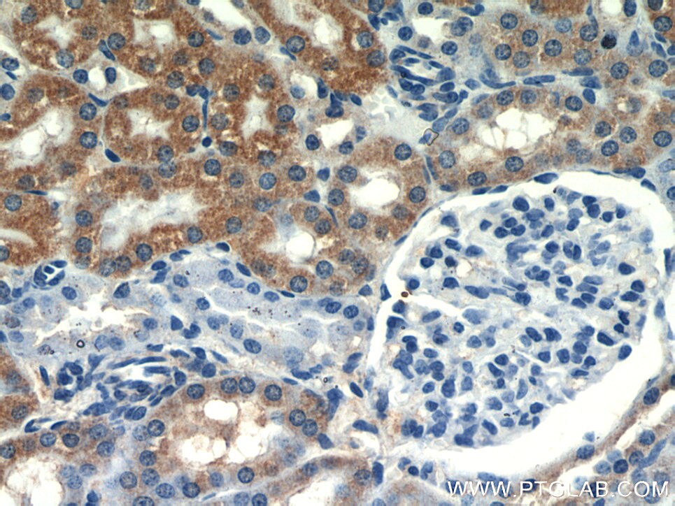 Immunohistochemistry (IHC) staining of mouse kidney tissue using SEPX1 Polyclonal antibody (15333-1-AP)