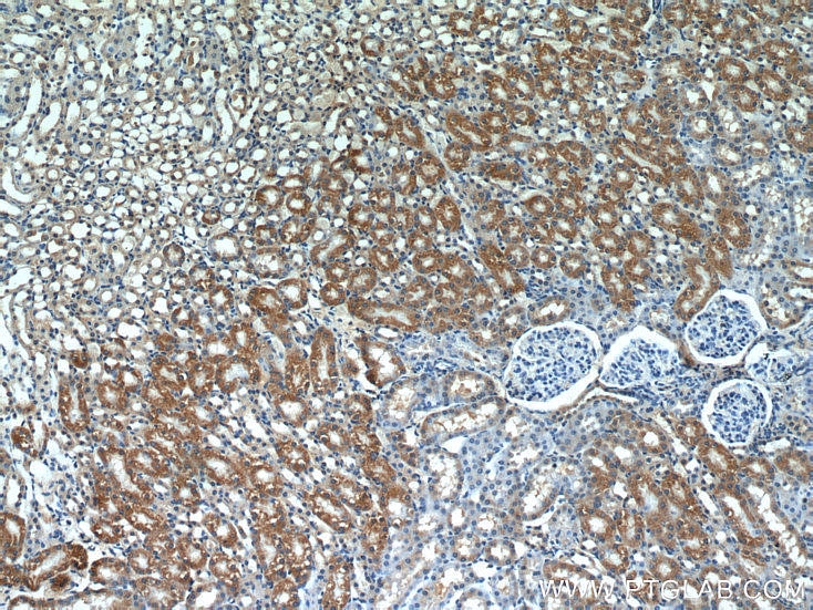 Immunohistochemistry (IHC) staining of mouse kidney tissue using SEPX1 Polyclonal antibody (15333-1-AP)