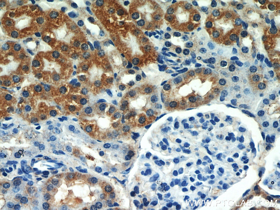 Immunohistochemistry (IHC) staining of mouse kidney tissue using SEPX1 Polyclonal antibody (15333-1-AP)