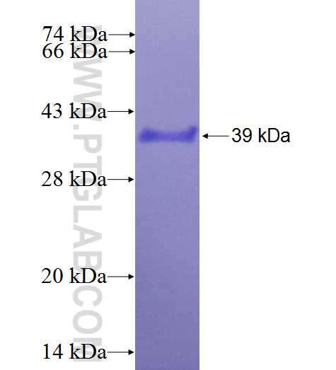 SEPX1 fusion protein Ag7391 SDS-PAGE