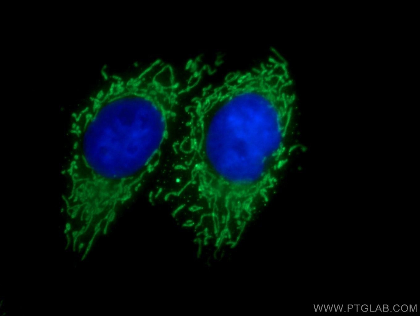 Immunofluorescence (IF) / fluorescent staining of HepG2 cells using SERAC1 Polyclonal antibody (25729-1-AP)