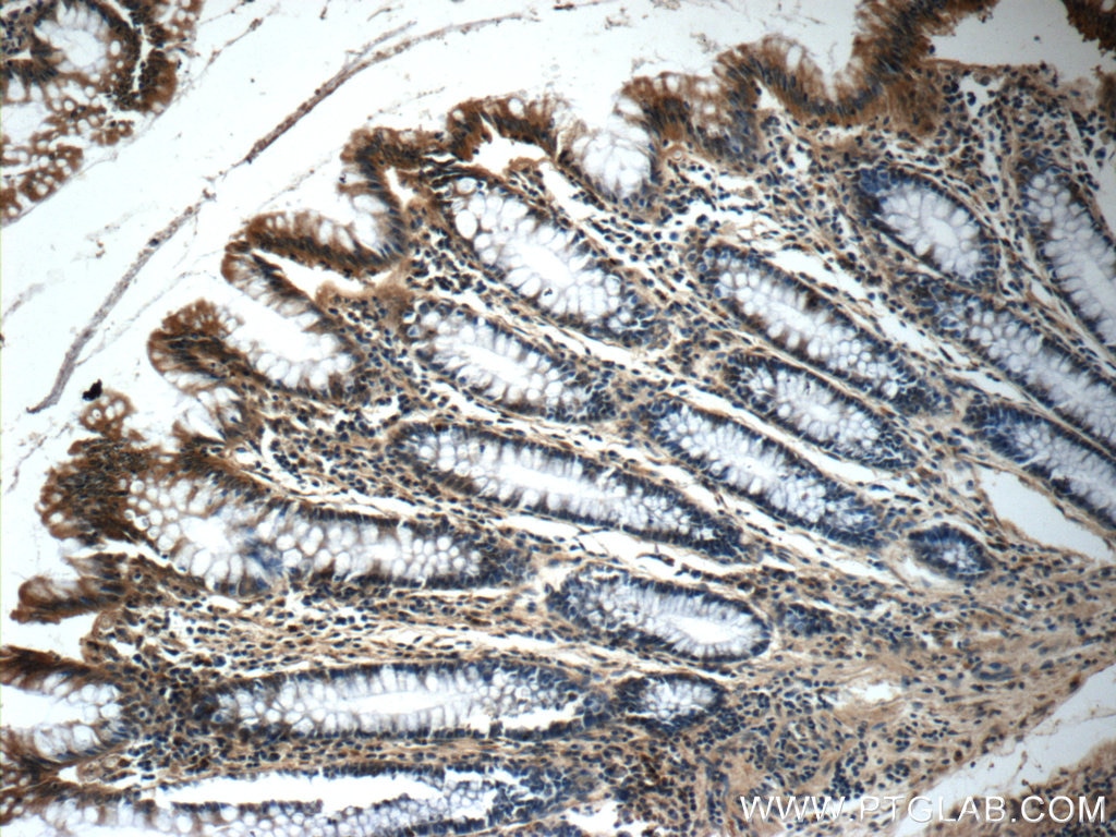 Immunohistochemistry (IHC) staining of human colon tissue using SERAC1 Polyclonal antibody (25729-1-AP)