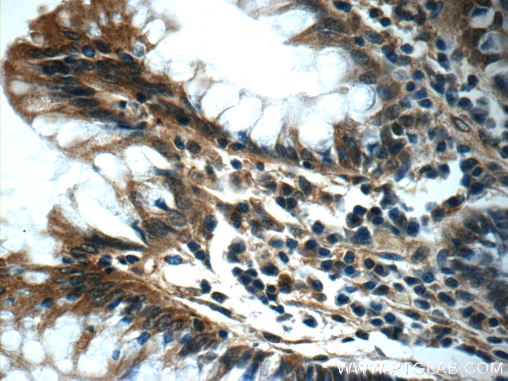 Immunohistochemistry (IHC) staining of human colon tissue using SERAC1 Polyclonal antibody (25729-1-AP)