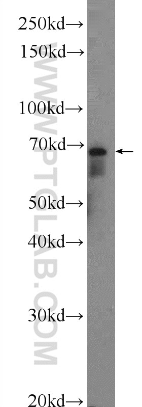 Western Blot (WB) analysis of mouse brain tissue using SERAC1 Polyclonal antibody (25729-1-AP)