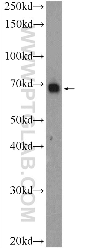 Western Blot (WB) analysis of HeLa cells using SERAC1 Polyclonal antibody (25729-1-AP)