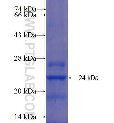 SERAC1 fusion protein Ag22790 SDS-PAGE