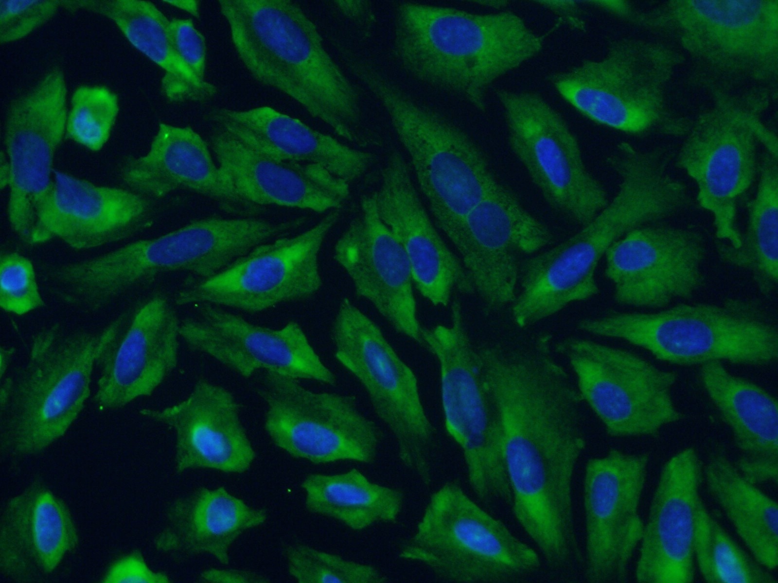 Immunofluorescence (IF) / fluorescent staining of U2OS cells using SERBP1 Polyclonal antibody (10729-1-AP)