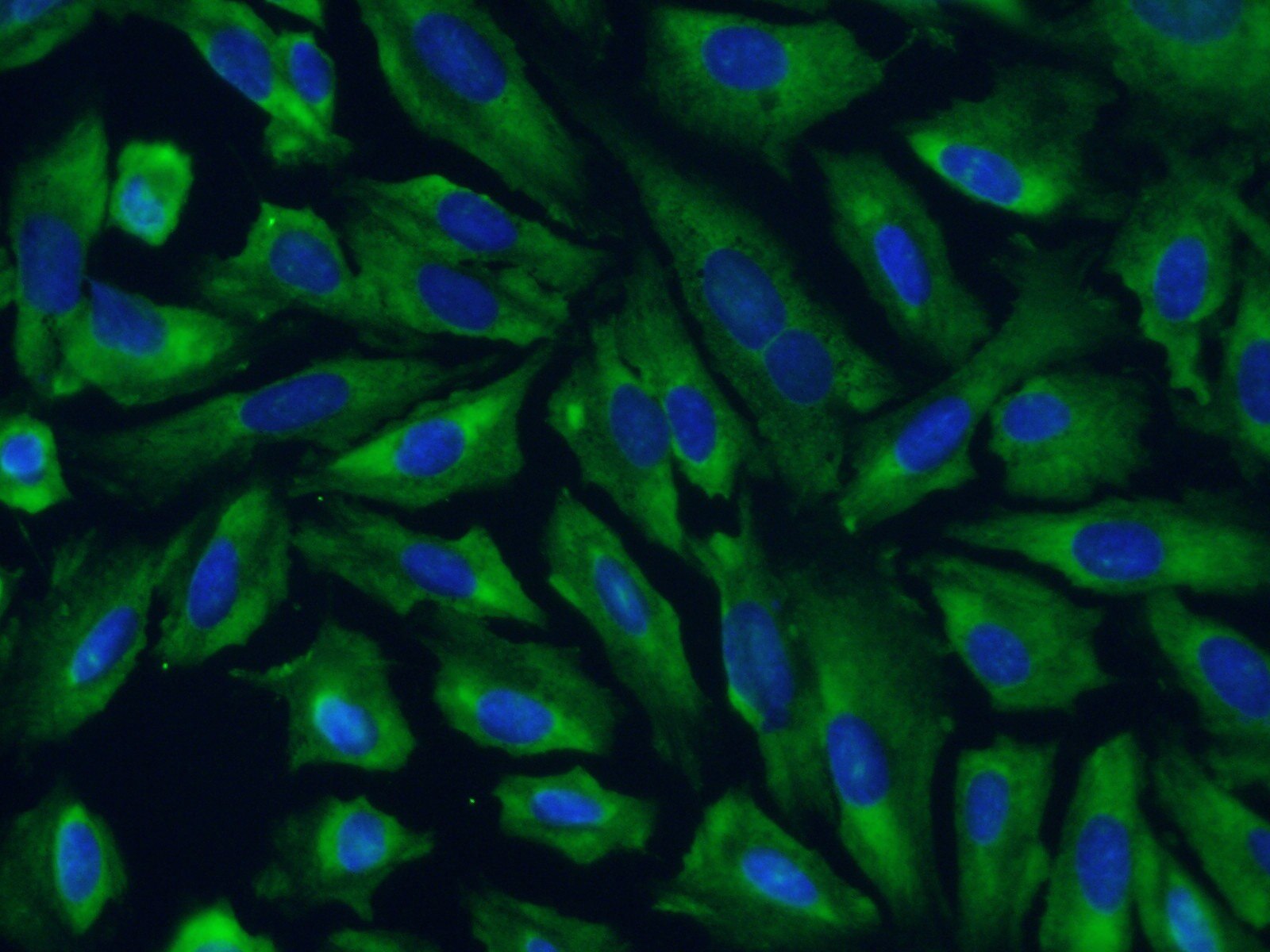 IF Staining of U2OS using 10729-1-AP