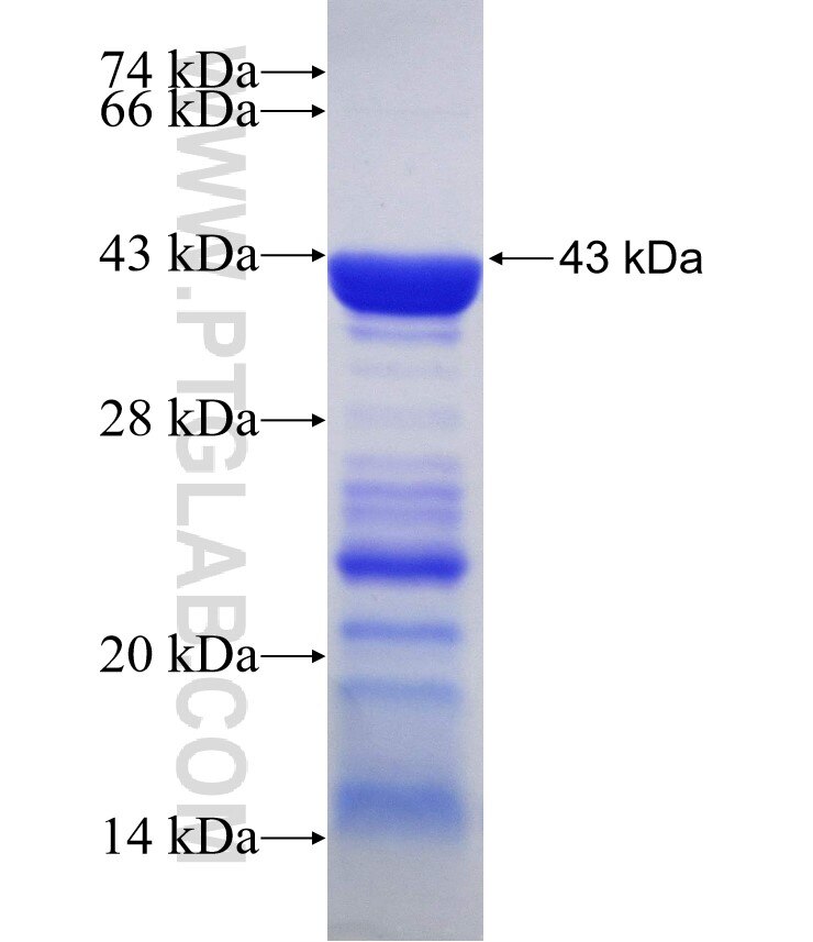 SERBP1 fusion protein Ag30202 SDS-PAGE