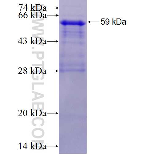 SERBP1 fusion protein Ag1045 SDS-PAGE