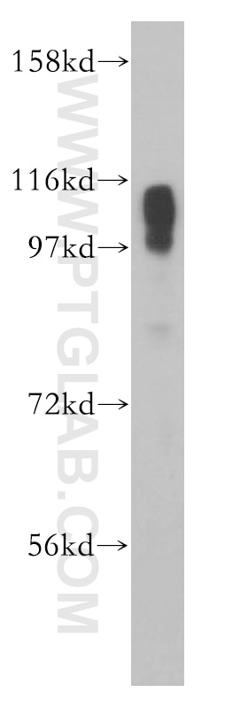 Western Blot (WB) analysis of mouse heart tissue using SERCA2 Polyclonal antibody (13985-1-AP)