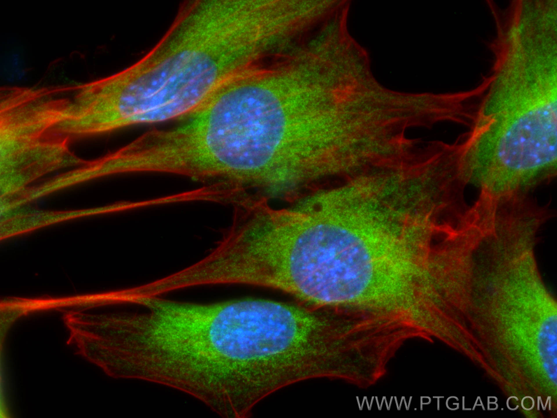 Immunofluorescence (IF) / fluorescent staining of C2C12 cells using SERCA2,ATP2A2 Polyclonal antibody (27311-1-AP)