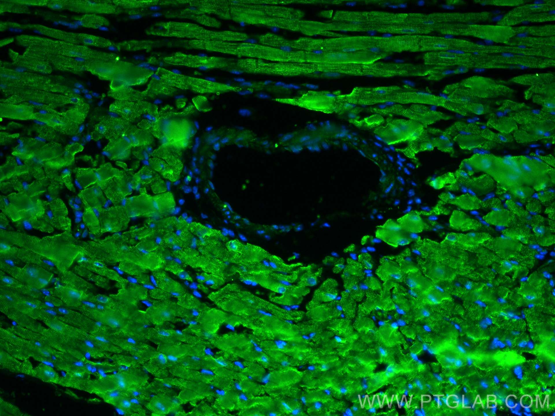 Immunofluorescence (IF) / fluorescent staining of mouse heart tissue using SERCA2,ATP2A2 Polyclonal antibody (27311-1-AP)