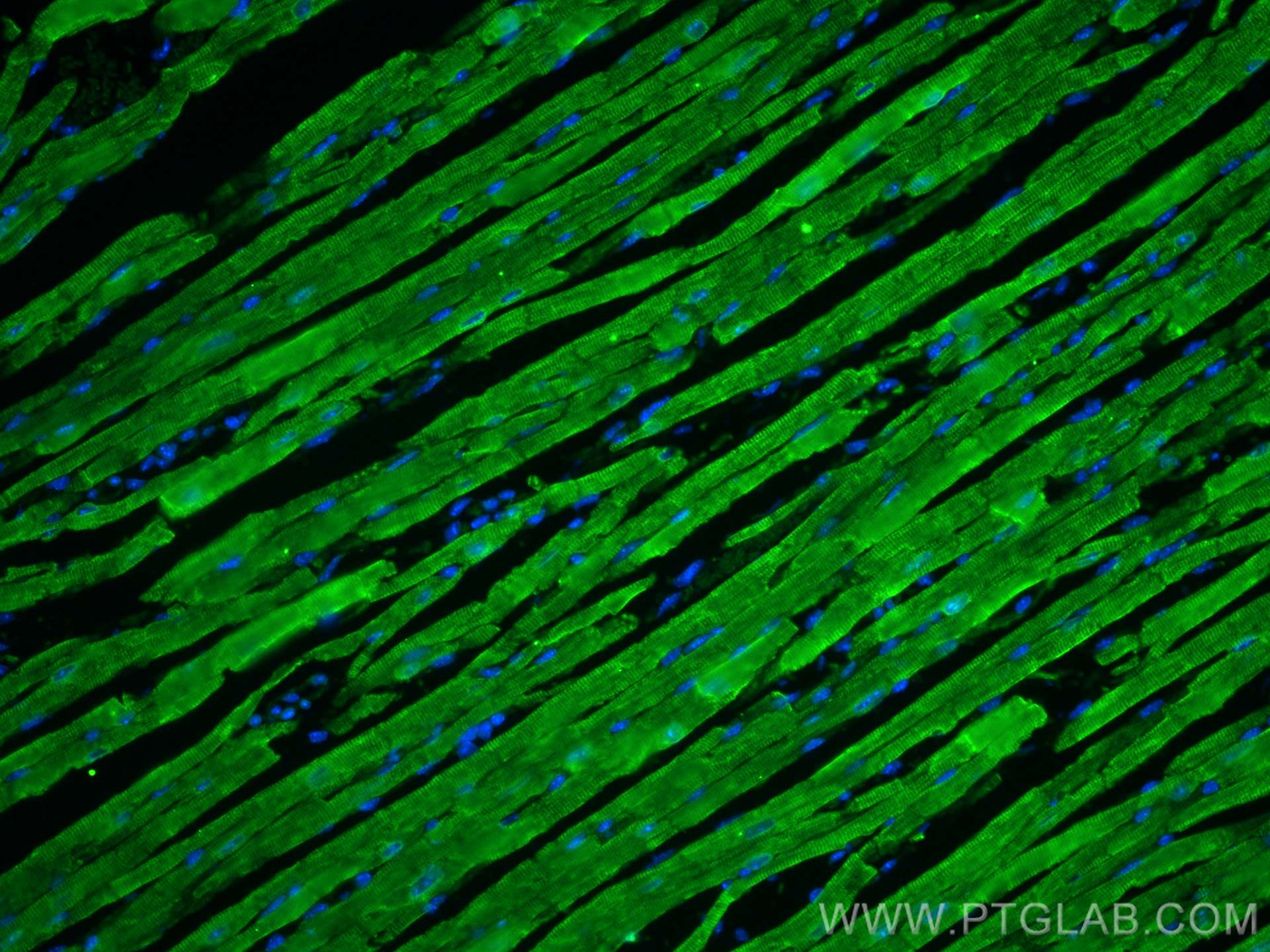 Immunofluorescence (IF) / fluorescent staining of mouse heart tissue using SERCA2,ATP2A2 Polyclonal antibody (27311-1-AP)