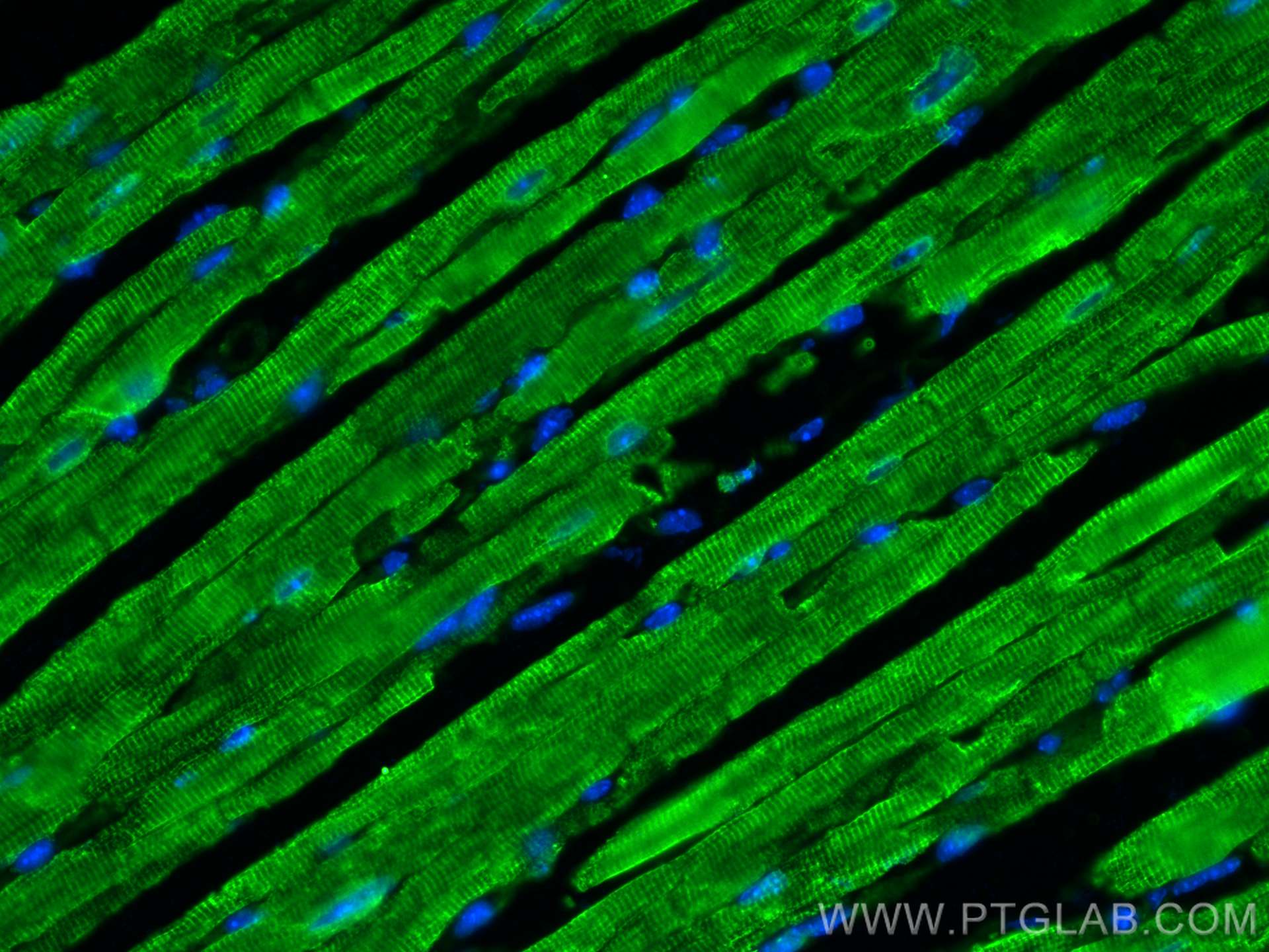 Immunofluorescence (IF) / fluorescent staining of mouse heart tissue using SERCA2,ATP2A2 Polyclonal antibody (27311-1-AP)