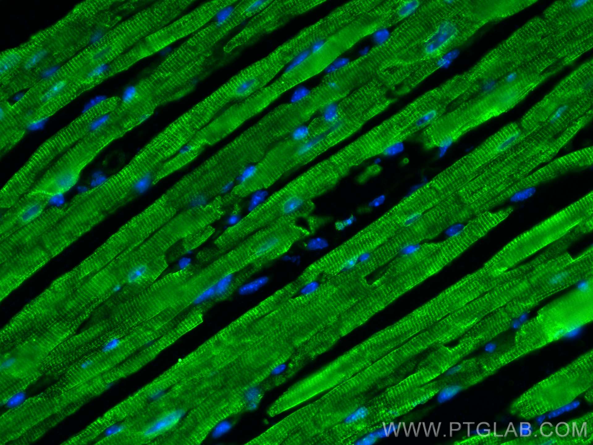 Immunofluorescence (IF) / fluorescent staining of mouse heart tissue using SERCA2,ATP2A2 Polyclonal antibody (27311-1-AP)