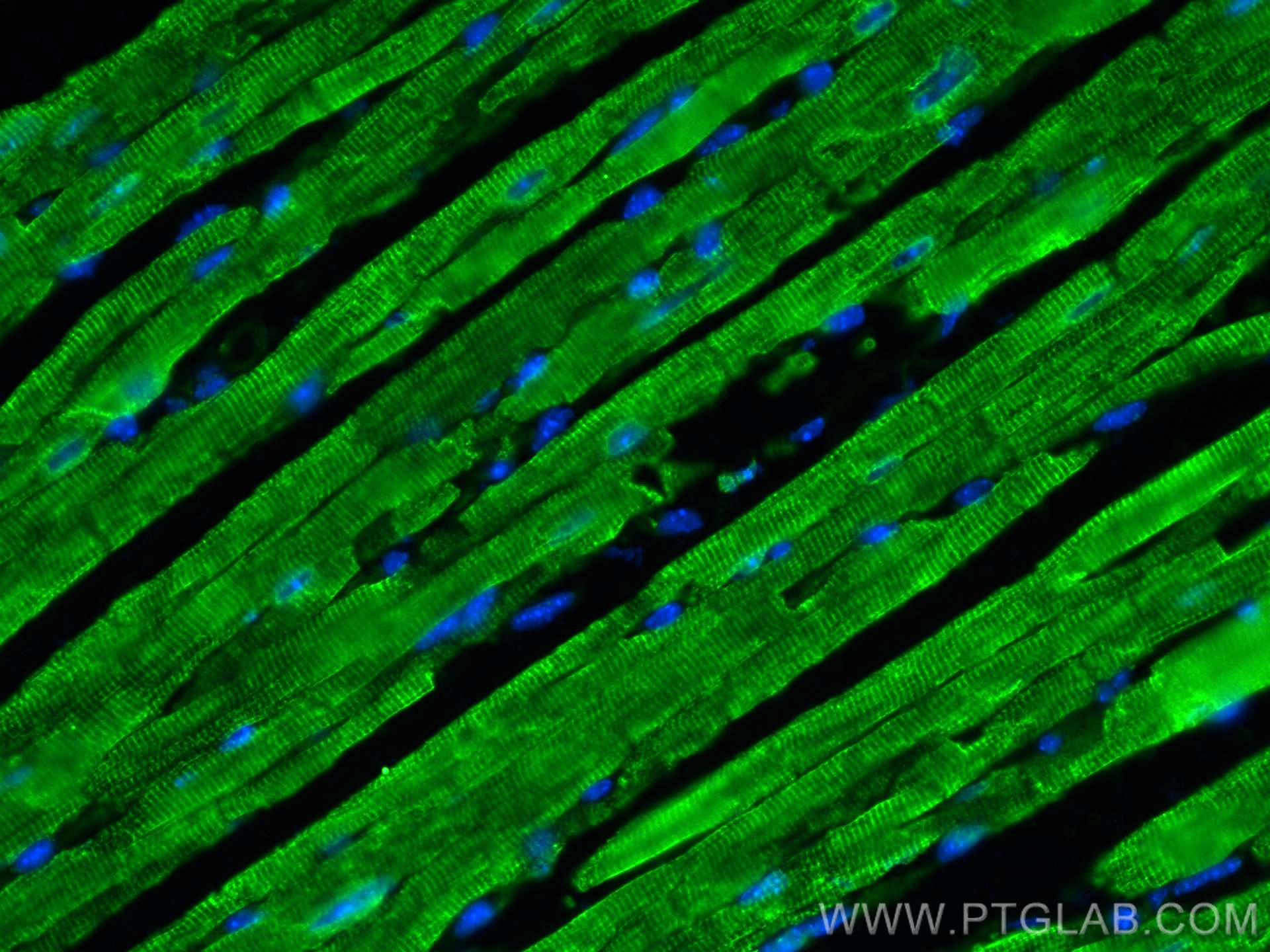 IF Staining of mouse heart using 27311-1-AP