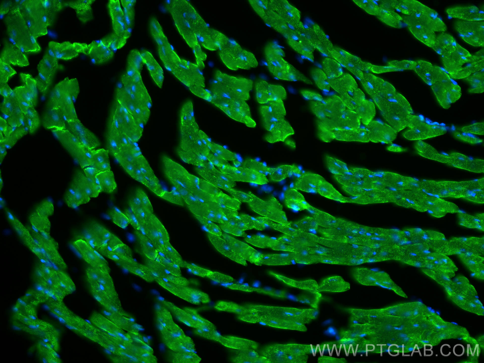Immunofluorescence (IF) / fluorescent staining of mouse heart tissue using SERCA2,ATP2A2 Polyclonal antibody (27311-1-AP)
