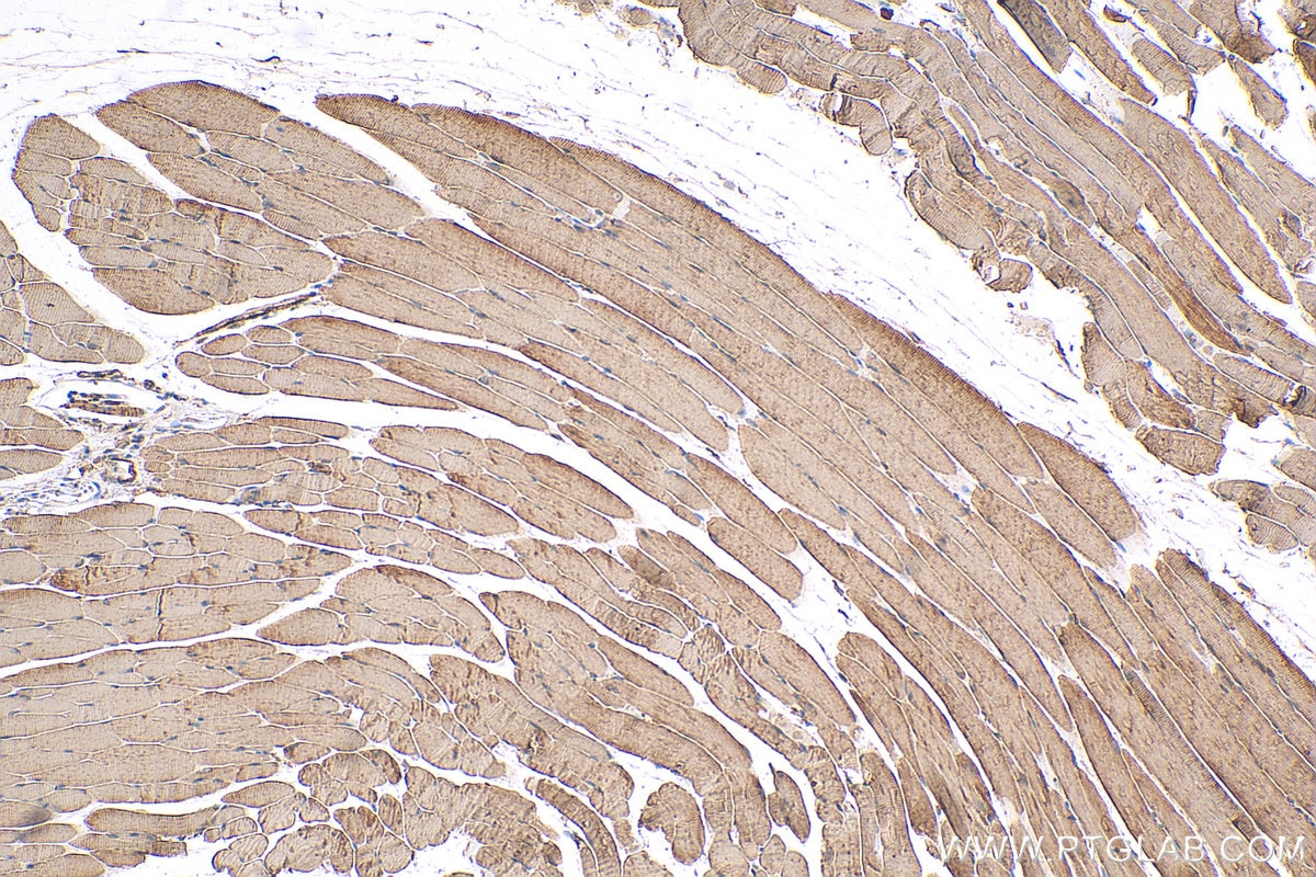 Immunohistochemistry (IHC) staining of mouse skeletal muscle tissue using SERCA2,ATP2A2 Polyclonal antibody (27311-1-AP)