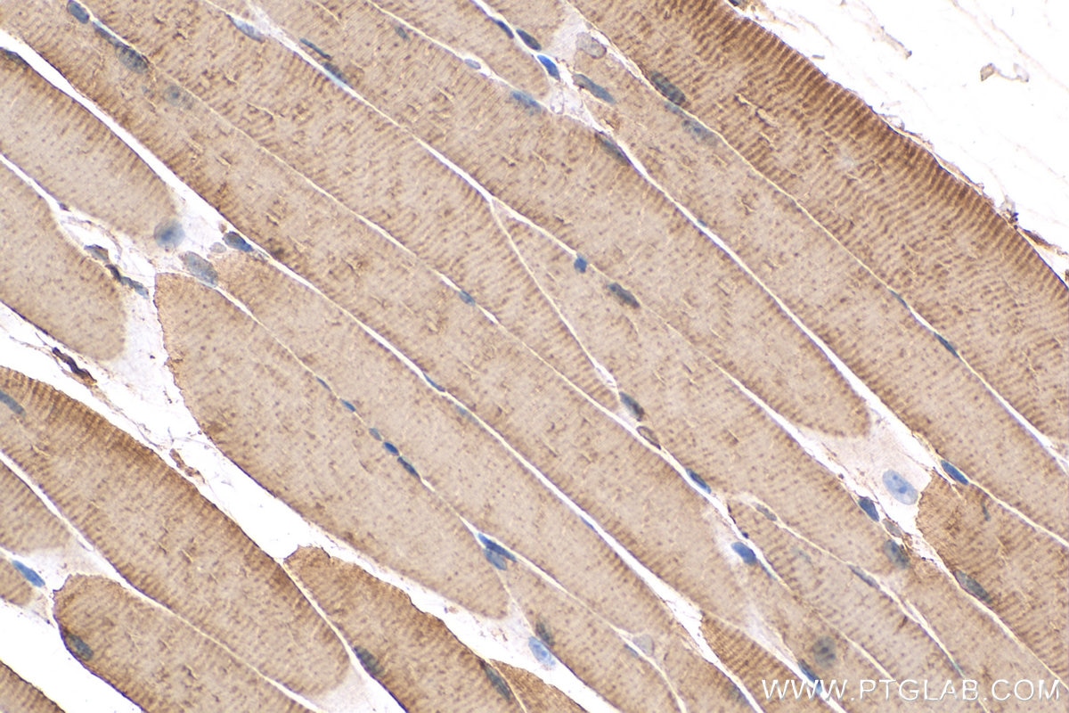 Immunohistochemistry (IHC) staining of mouse skeletal muscle tissue using SERCA2,ATP2A2 Polyclonal antibody (27311-1-AP)