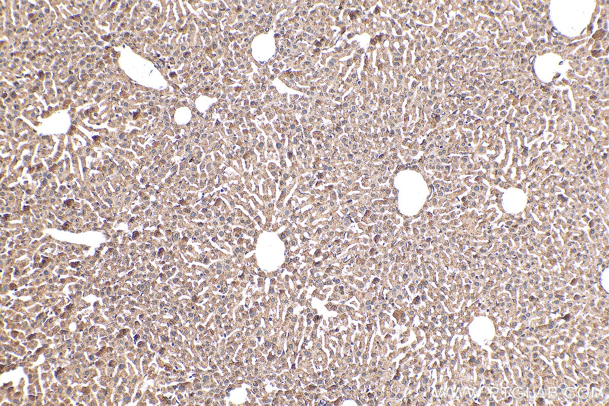 Immunohistochemistry (IHC) staining of mouse liver tissue using SERCA2,ATP2A2 Polyclonal antibody (27311-1-AP)