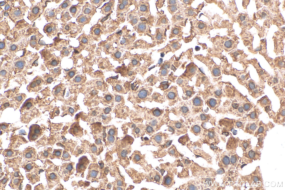 Immunohistochemistry (IHC) staining of mouse liver tissue using SERCA2,ATP2A2 Polyclonal antibody (27311-1-AP)