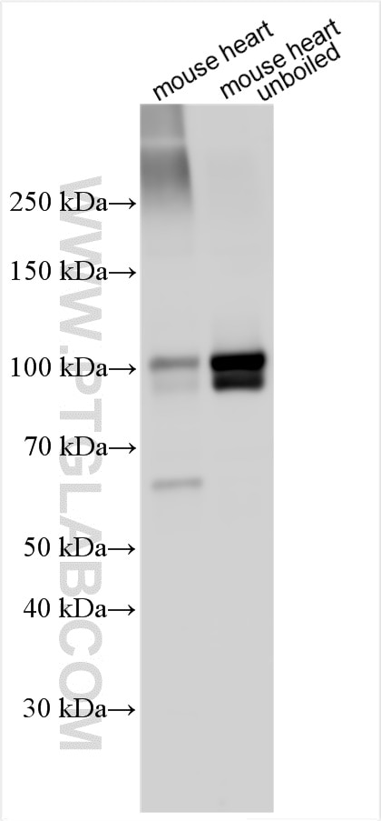 SERCA2,ATP2A2