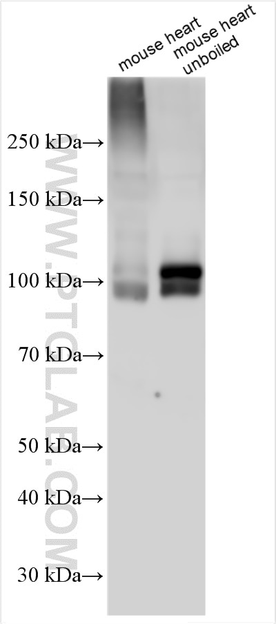 Western Blot (WB) analysis of various lysates using SERCA2,ATP2A2 Polyclonal antibody (27311-1-AP)