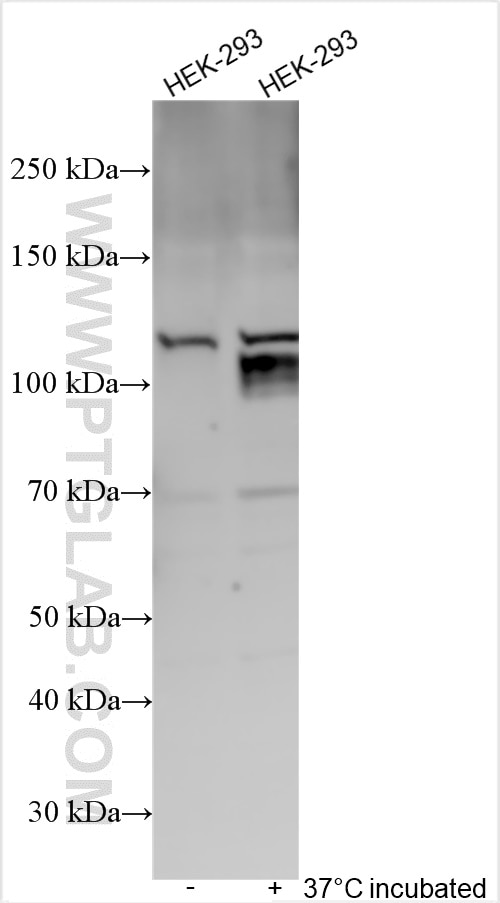 Western Blot (WB) analysis of various lysates using SERCA2,ATP2A2 Polyclonal antibody (27311-1-AP)
