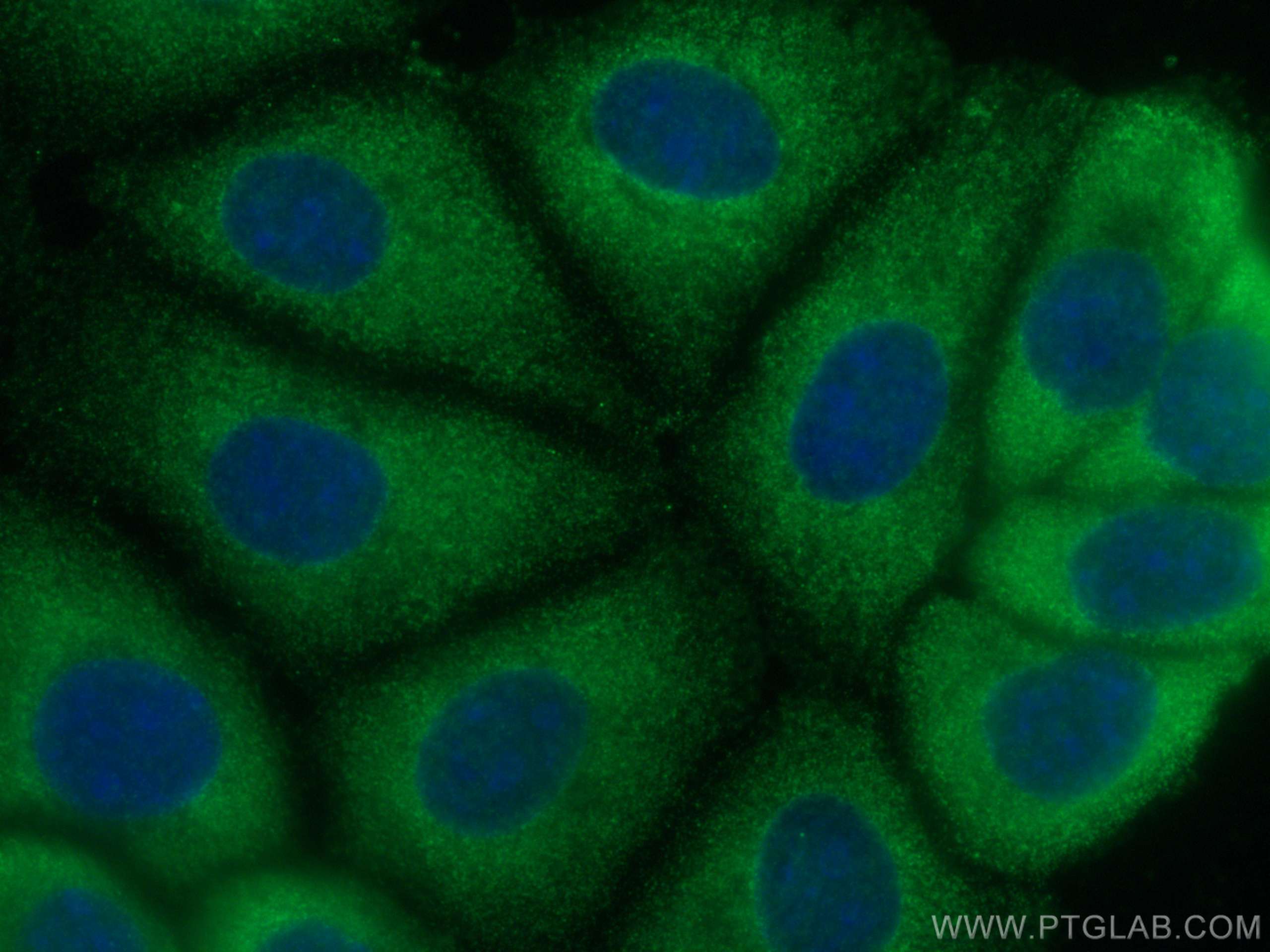 Immunofluorescence (IF) / fluorescent staining of MCF-7 cells using SERCA2,ATP2A2 Monoclonal antibody (67248-1-Ig)