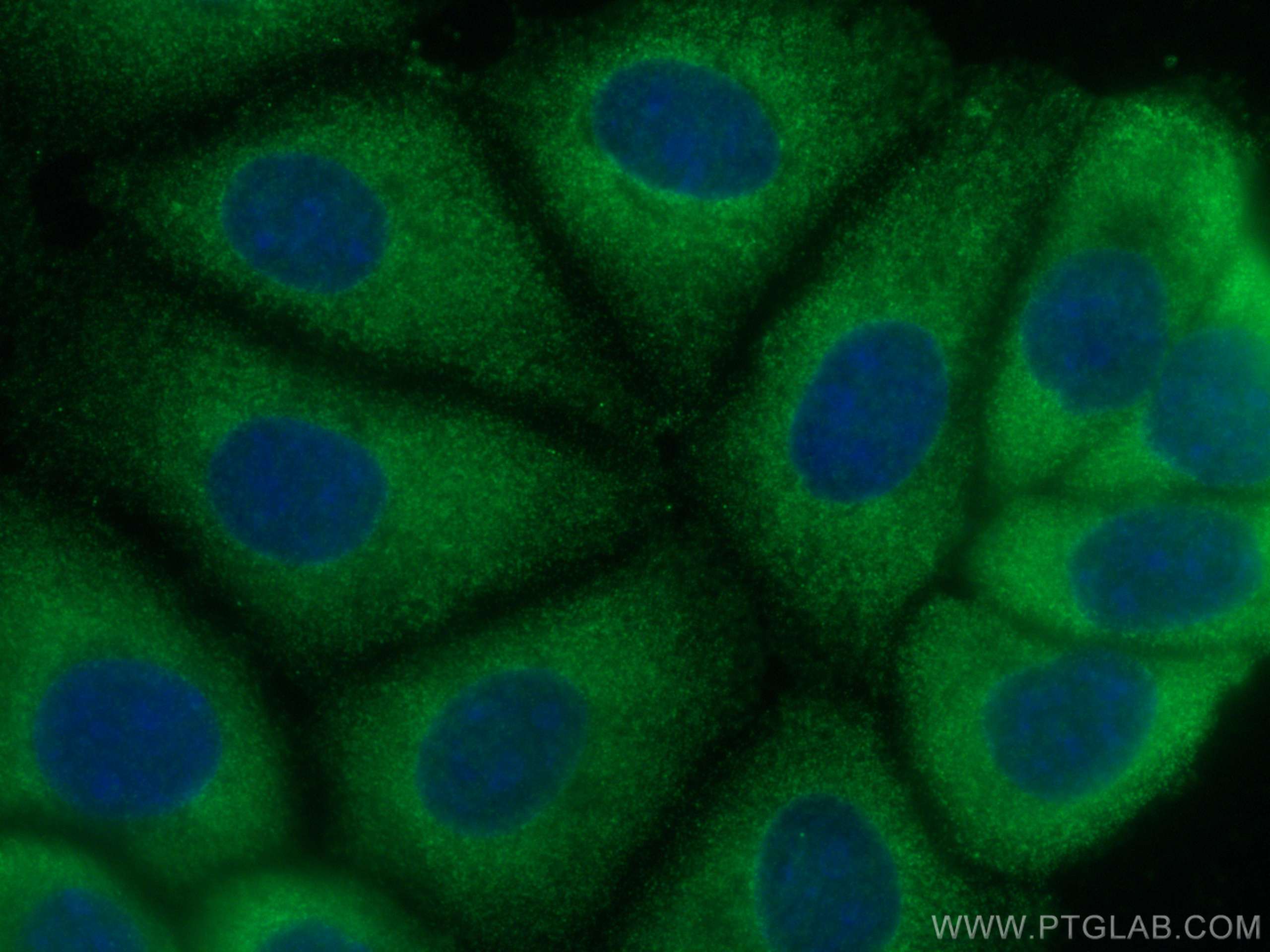 Immunofluorescence (IF) / fluorescent staining of MCF-7 cells using SERCA2,ATP2A2 Monoclonal antibody (67248-1-Ig)