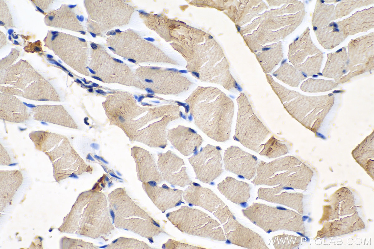 Immunohistochemistry (IHC) staining of mouse skeletal muscle tissue using SERCA2,ATP2A2 Monoclonal antibody (67248-1-Ig)