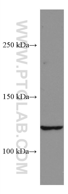 Western Blot (WB) analysis of HEK-293 cells using SERCA2,ATP2A2 Monoclonal antibody (67248-1-Ig)