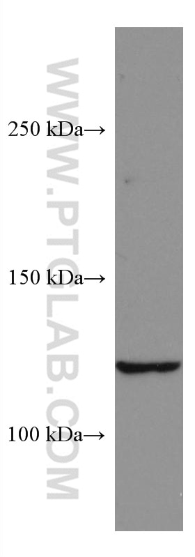 WB analysis of HEK-293 using 67248-1-Ig